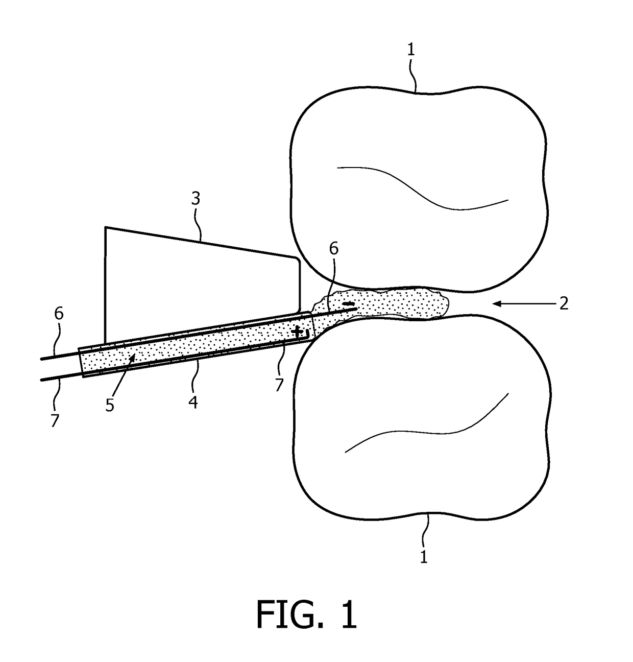 Method and system for oral ph change