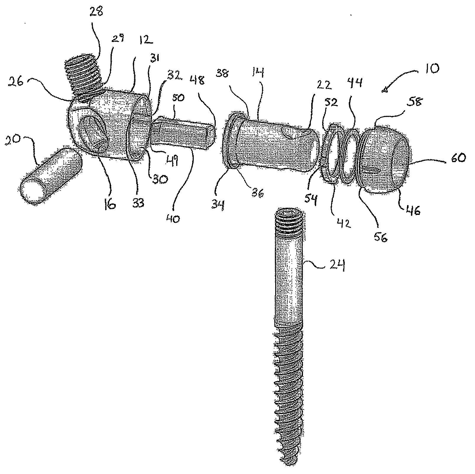 Variable Angle Connection Assembly