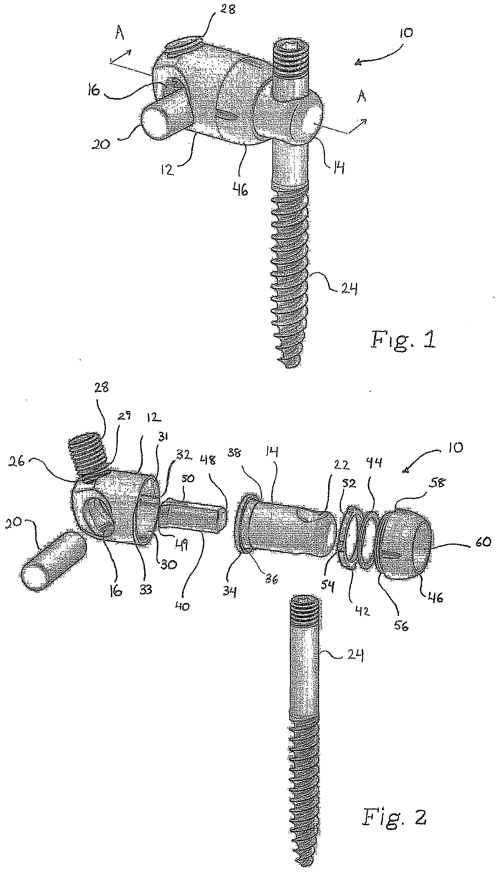 Variable Angle Connection Assembly