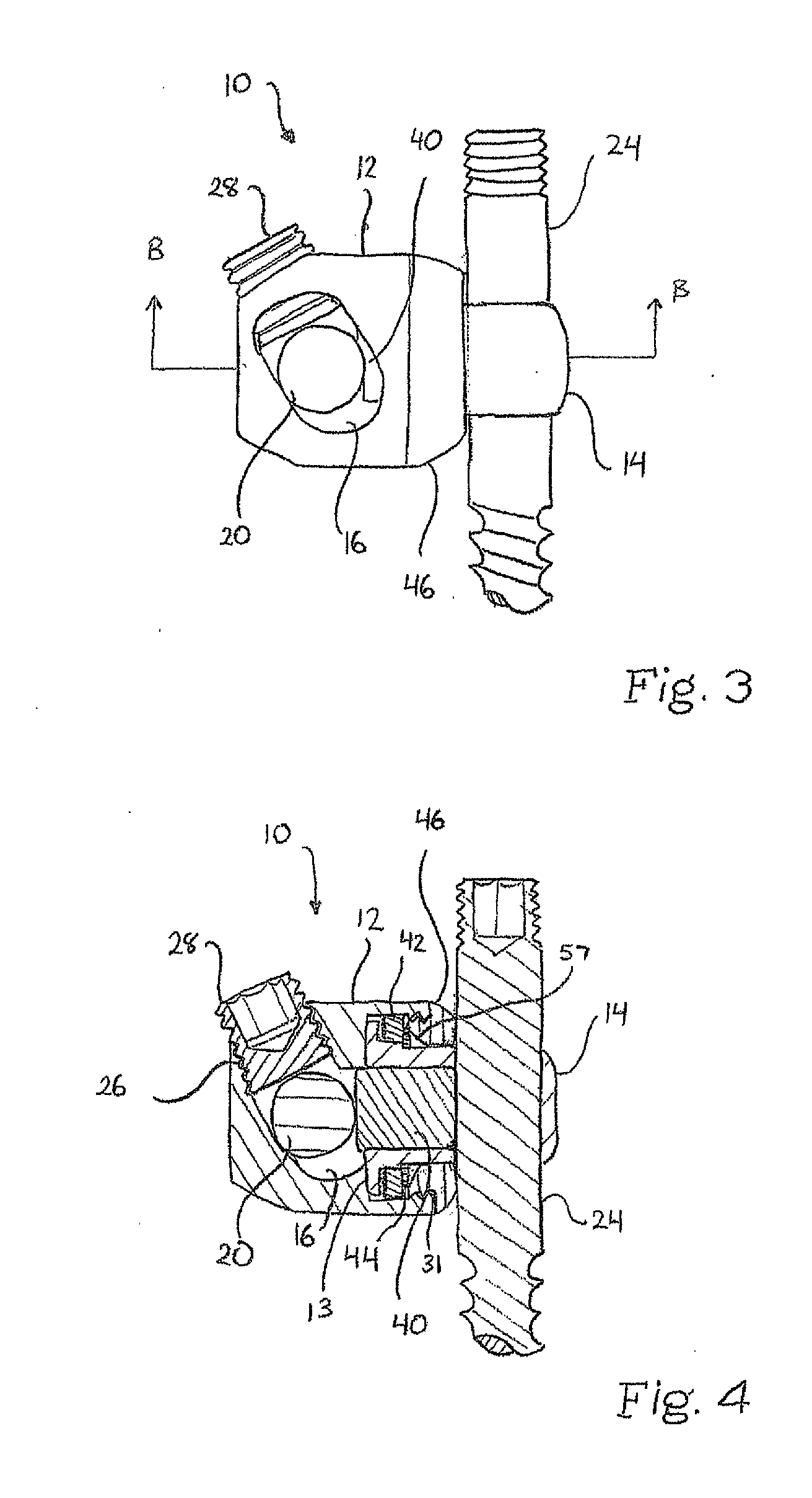 Variable Angle Connection Assembly