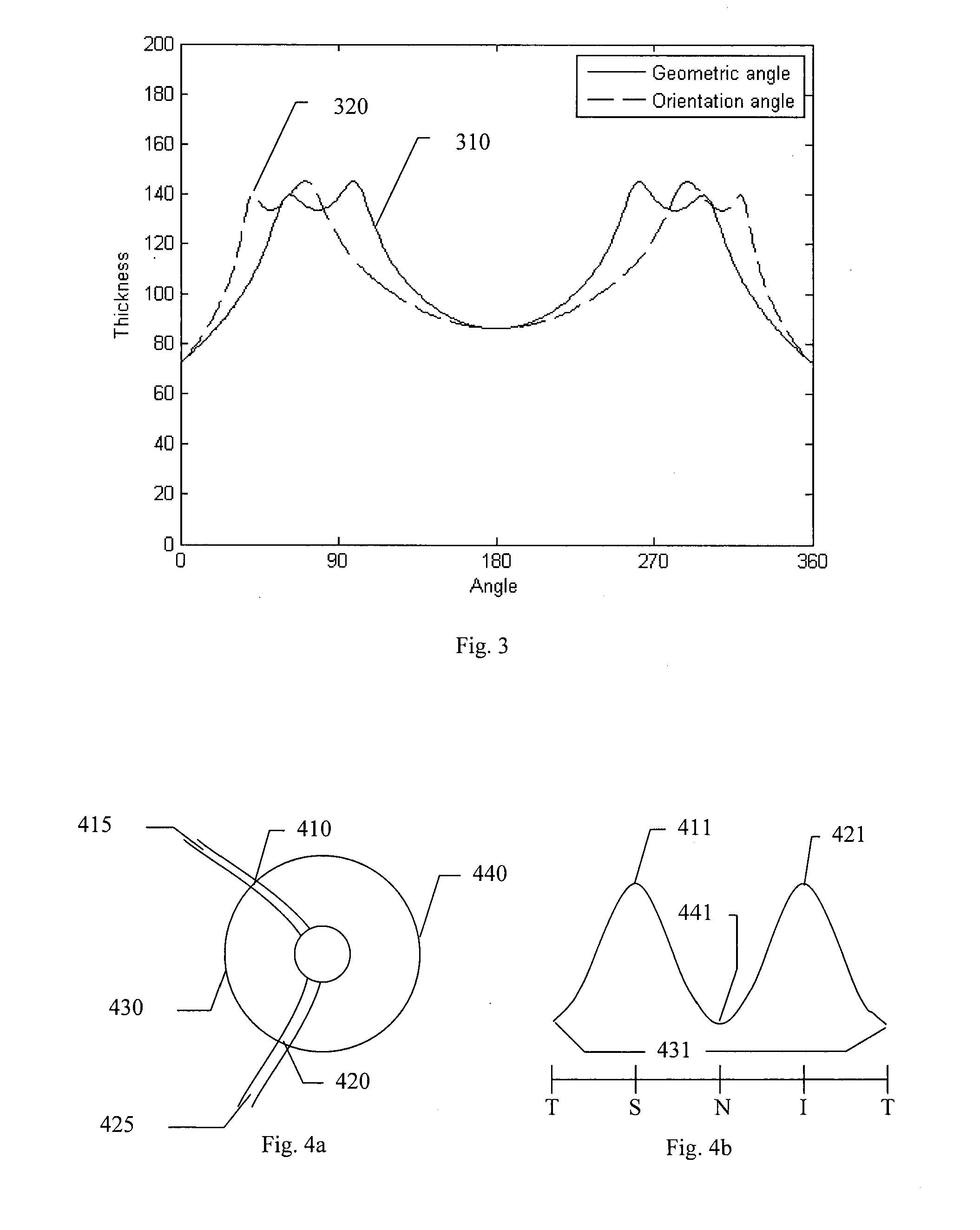 Rnfl measurement analysis