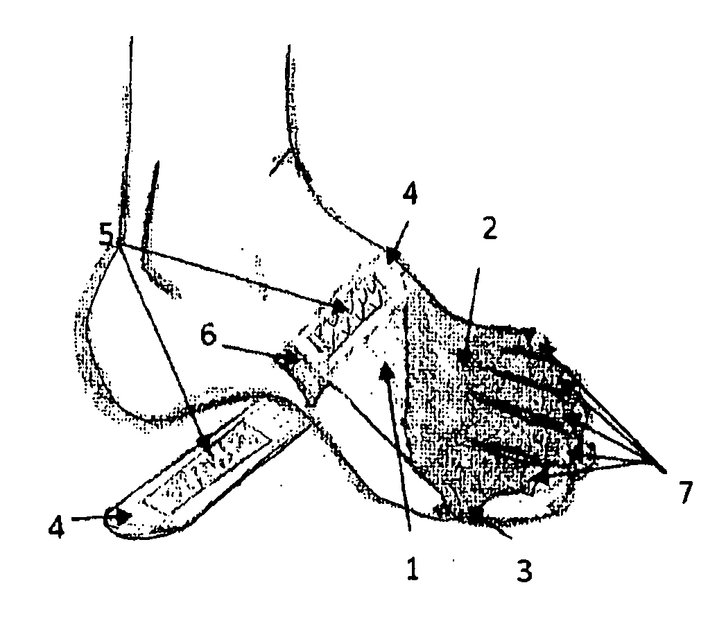 Toe Shield Glove (TSG)