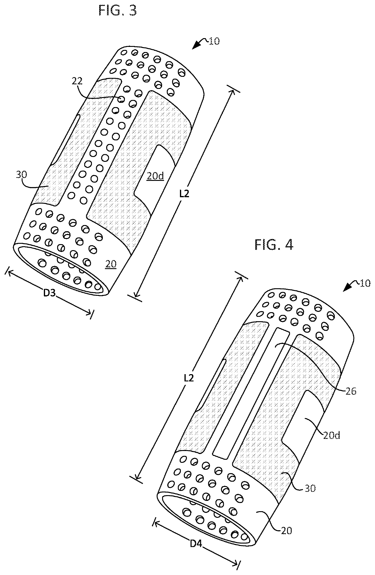 Splint