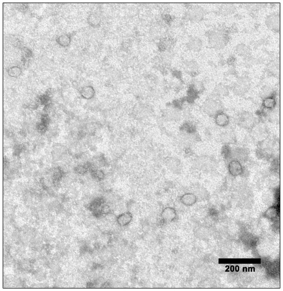 Preparation method and application of immune cell exosomes carrying chimeric antigen receptors