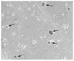 Inducing method and inducing culture medium for differentiation of bone marrow mesenchymal stem cells into osteoblasts in vitro