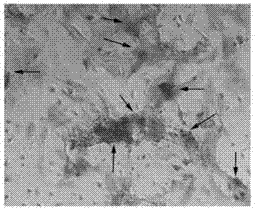 Inducing method and inducing culture medium for differentiation of bone marrow mesenchymal stem cells into osteoblasts in vitro