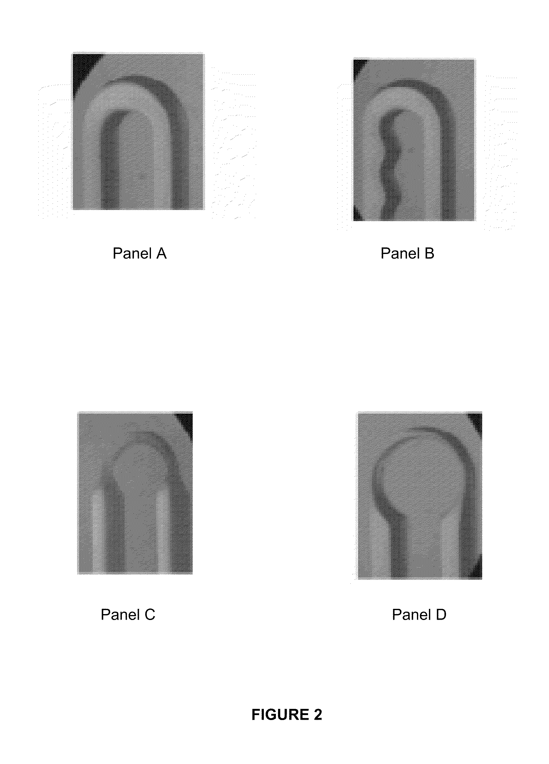 Column design for micro gas chromatograph