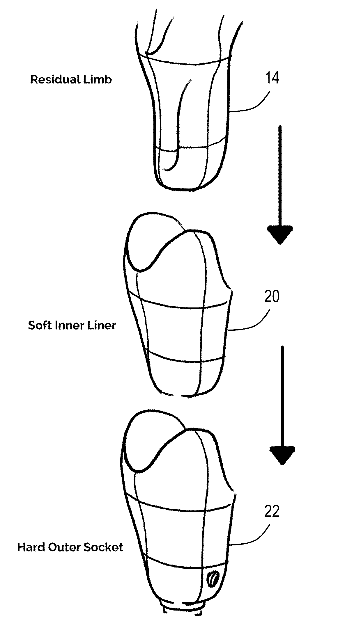 Prosthetic limb socket with variable harness