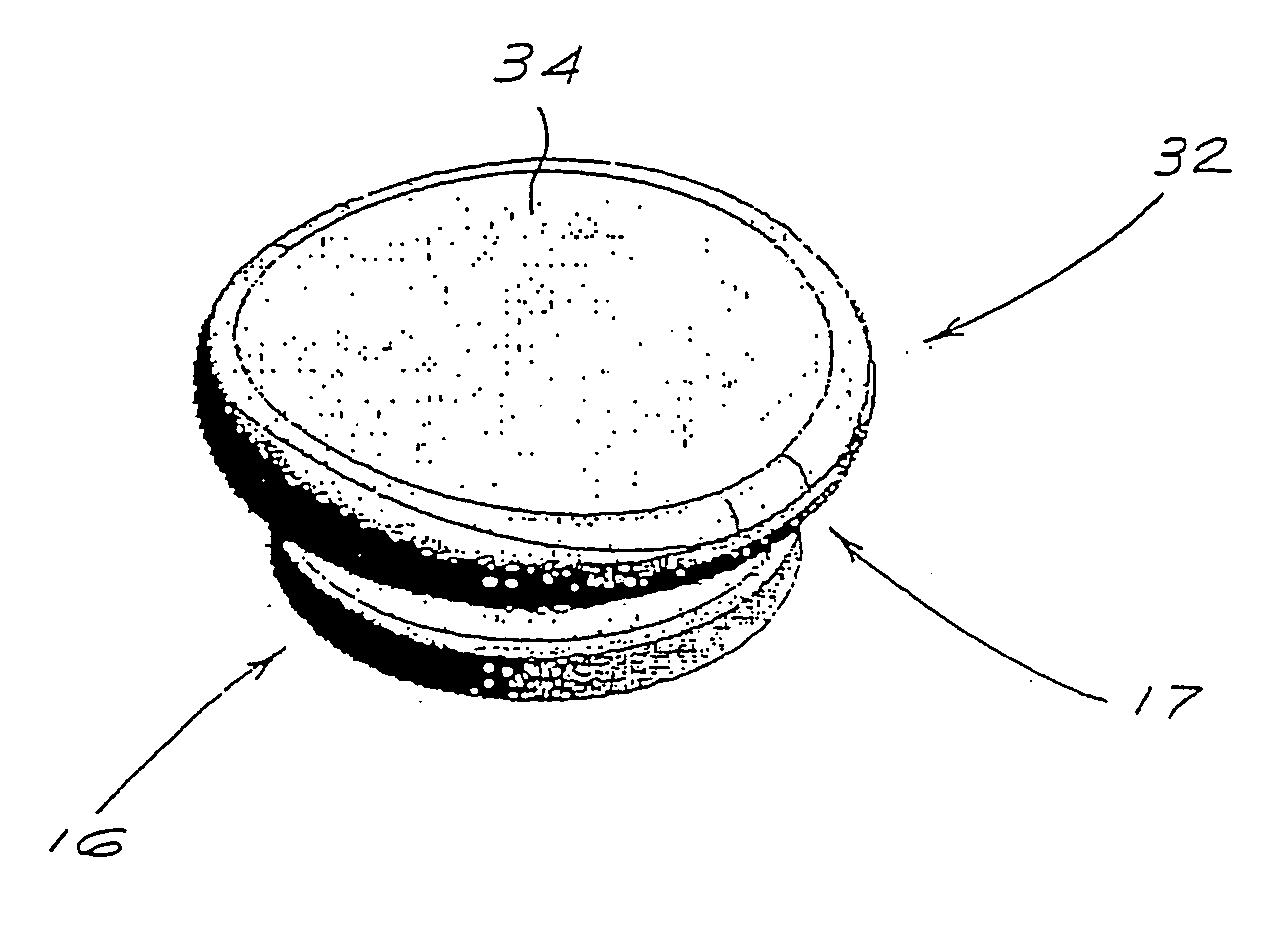 Arthroplasty implant