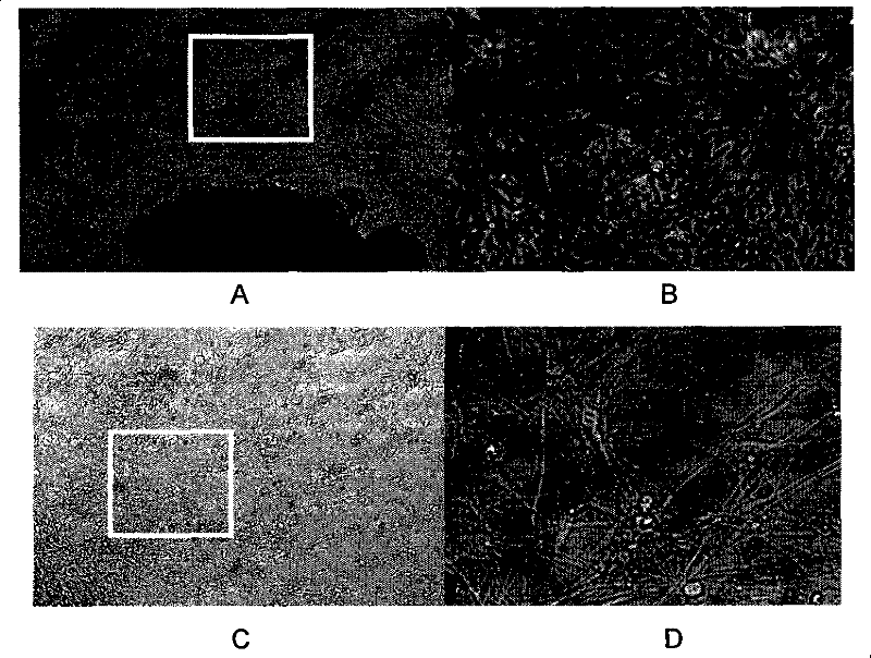 Use of neurocyte differentiated from stem cell induced by isobavachin