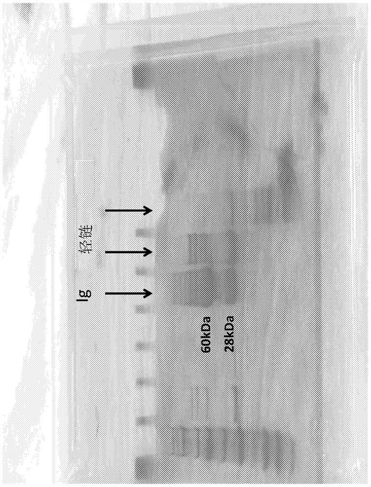 Modified monocytes/macrophages/dendritic cells expressing chimeric antigen receptors and uses in diseases and disorders associated with protein aggregates