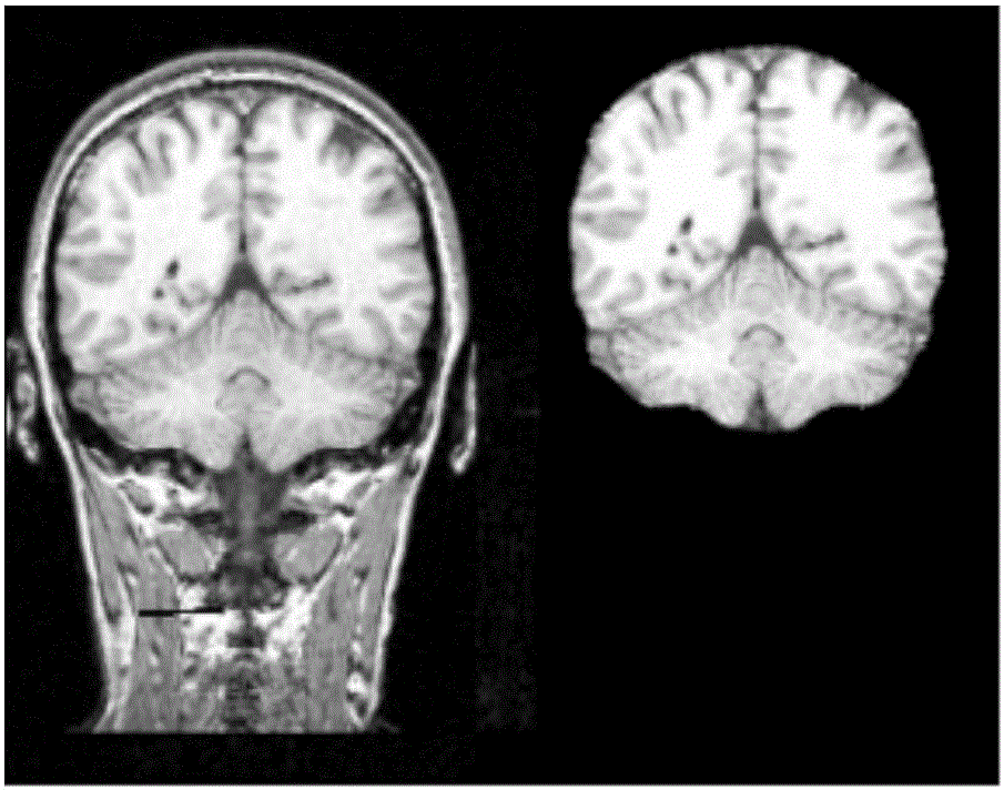 Amygdaloid nucleus spectral clustering segmentation method based on resting state function connection