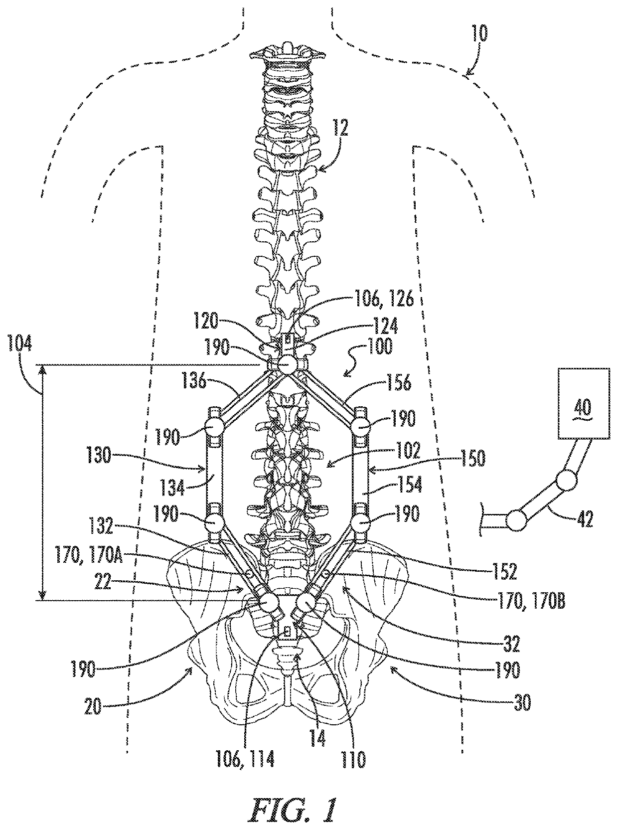 Spinal stabilization apparatus for the detection and prevention of a loss of robotic accuracy and method thereof