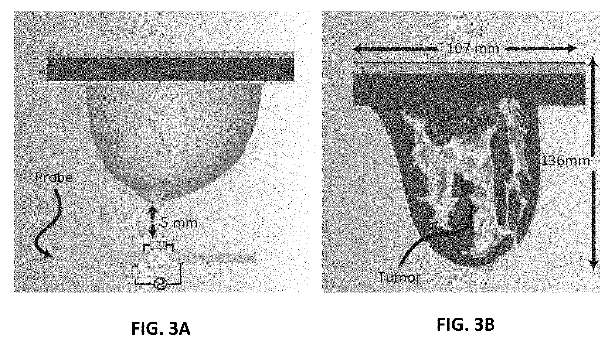 Breast cancer detection using near-field probes with machine learning techniques