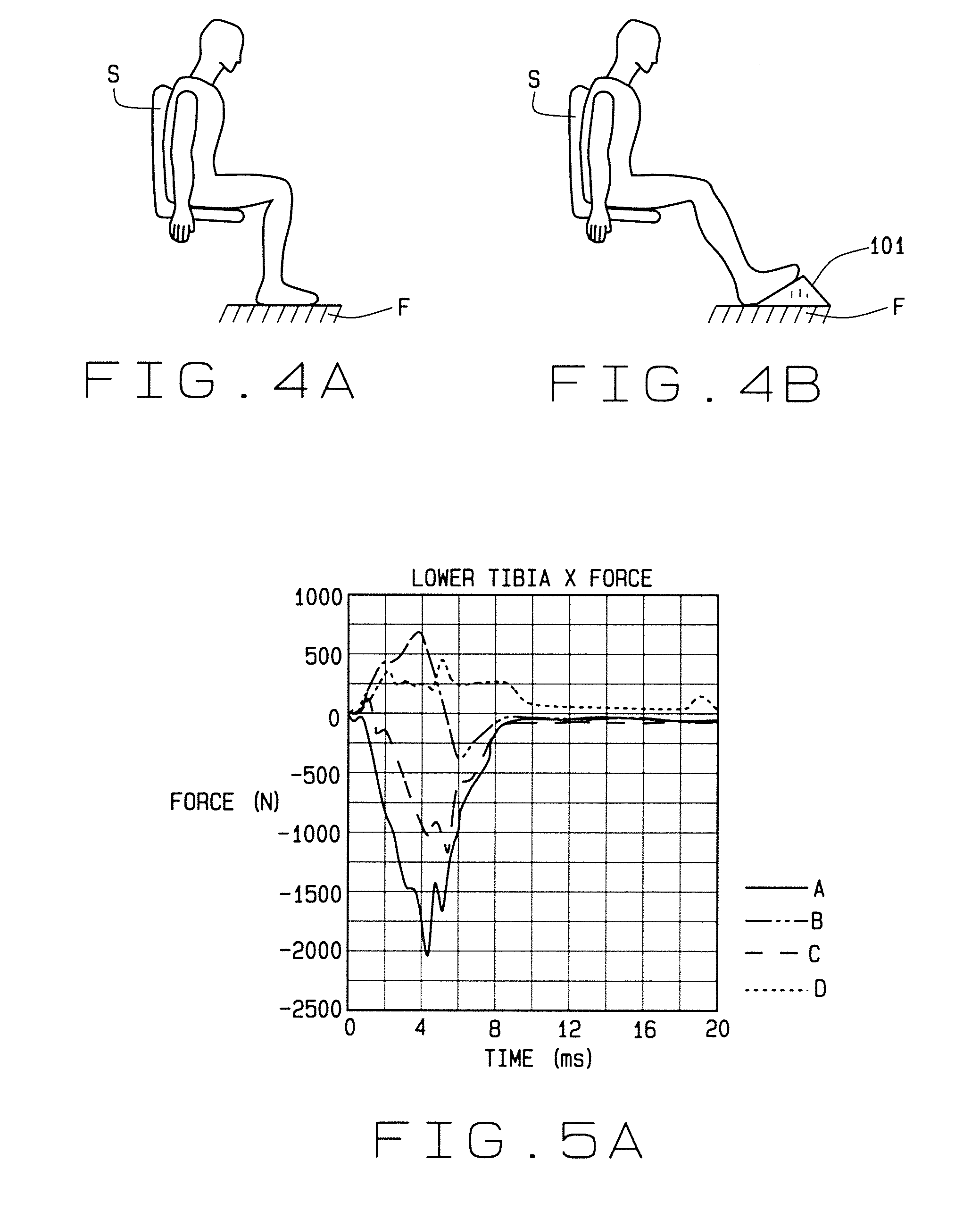 Tibia force reduction wedge