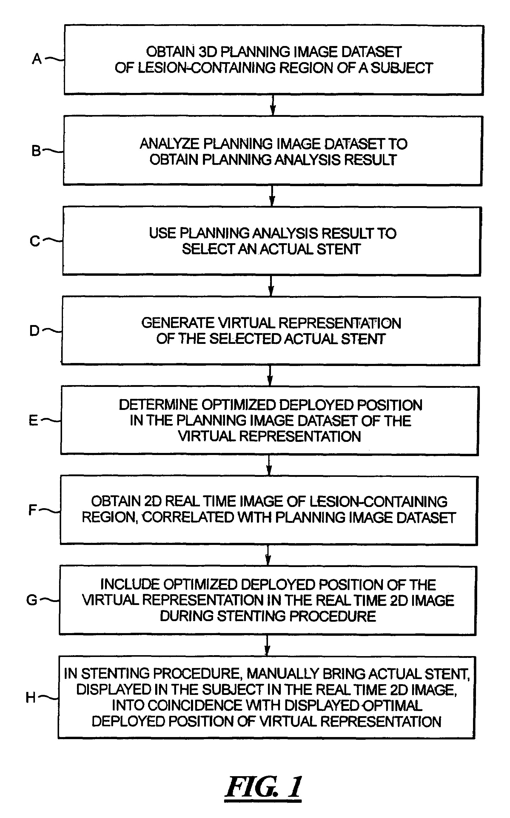 Computerized workflow method for stent planning and stenting procedure