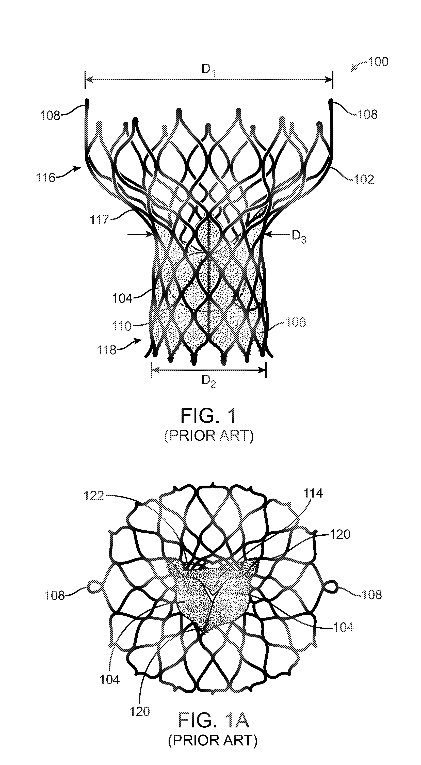 Methods and devices for repairing and/or preventing paravalvular leakage post-implantation of a valve prosthesis