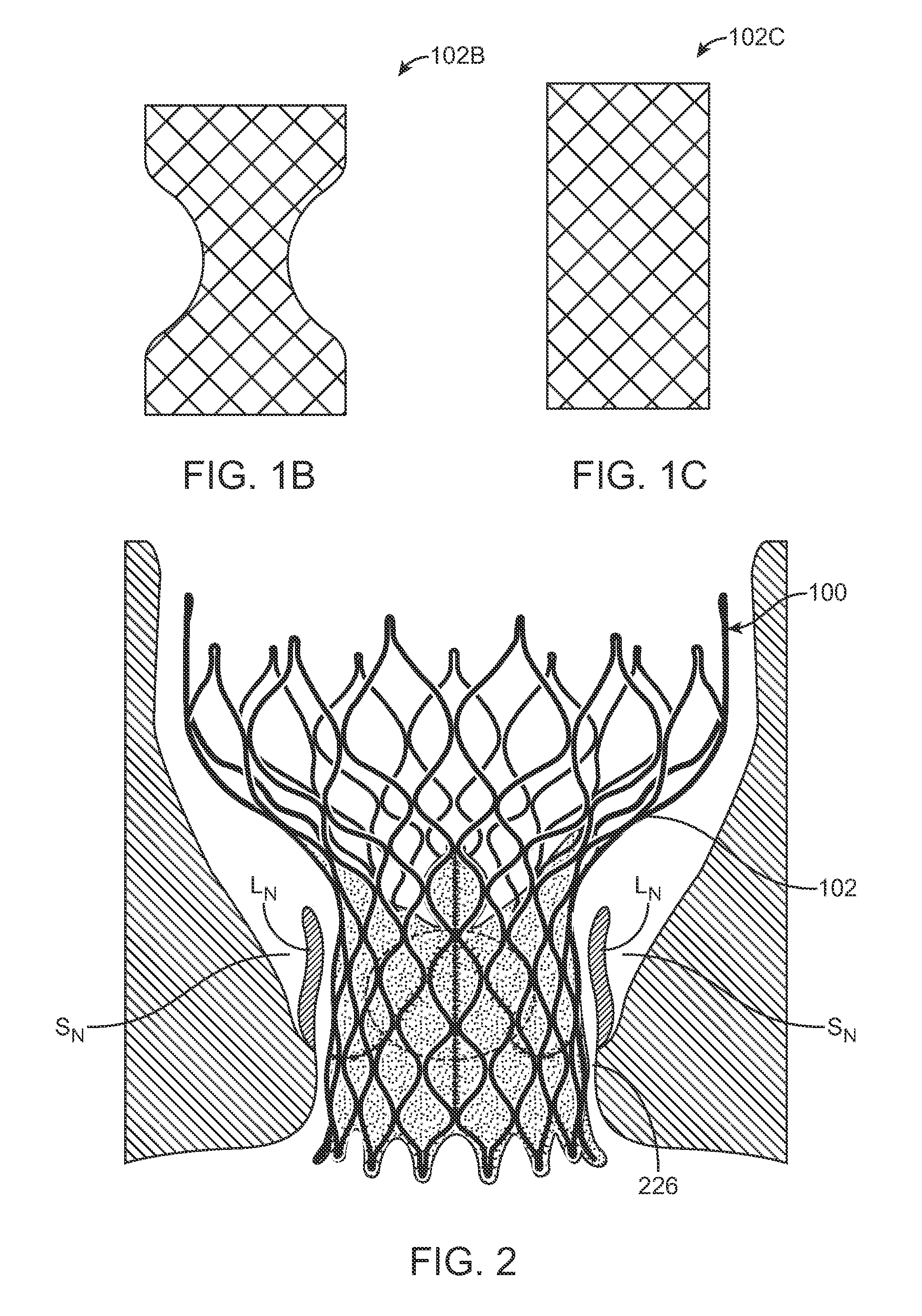 Methods and devices for repairing and/or preventing paravalvular leakage post-implantation of a valve prosthesis