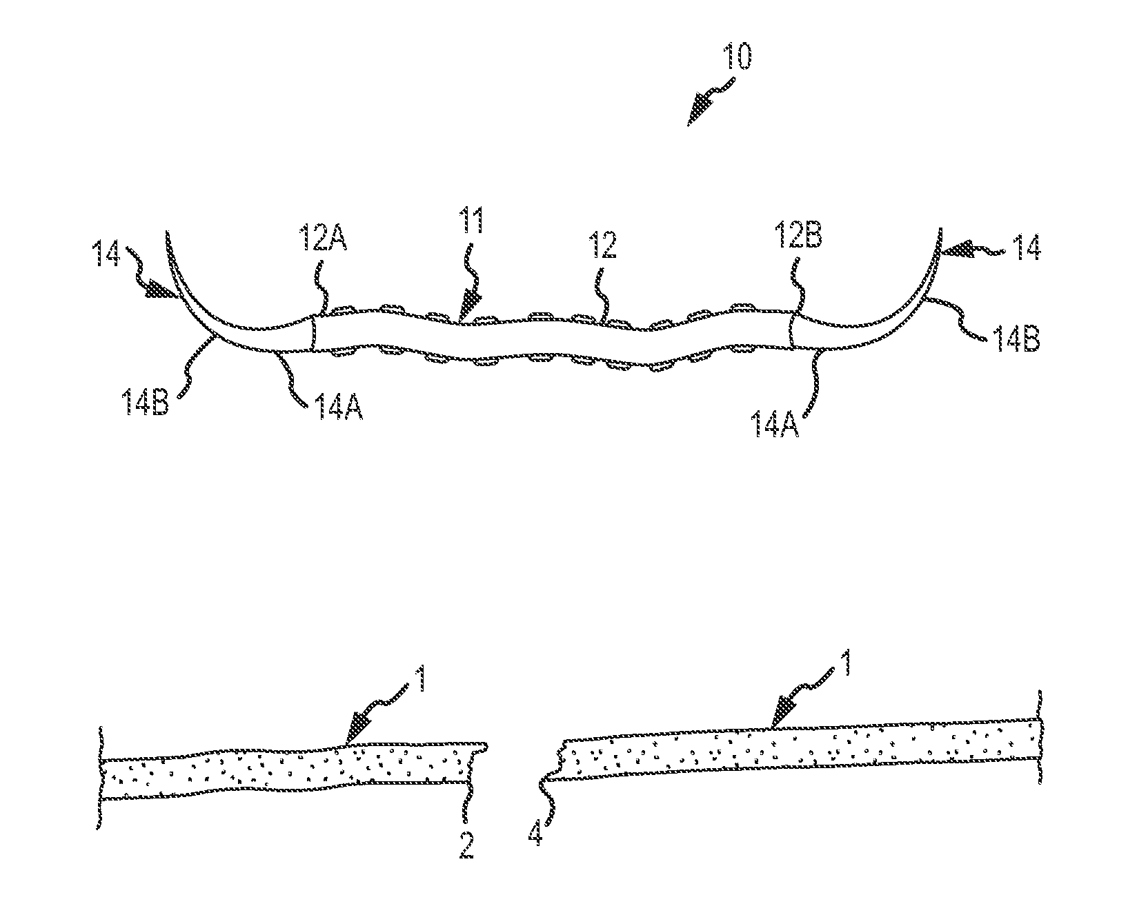 Devices and methods for tendon repair