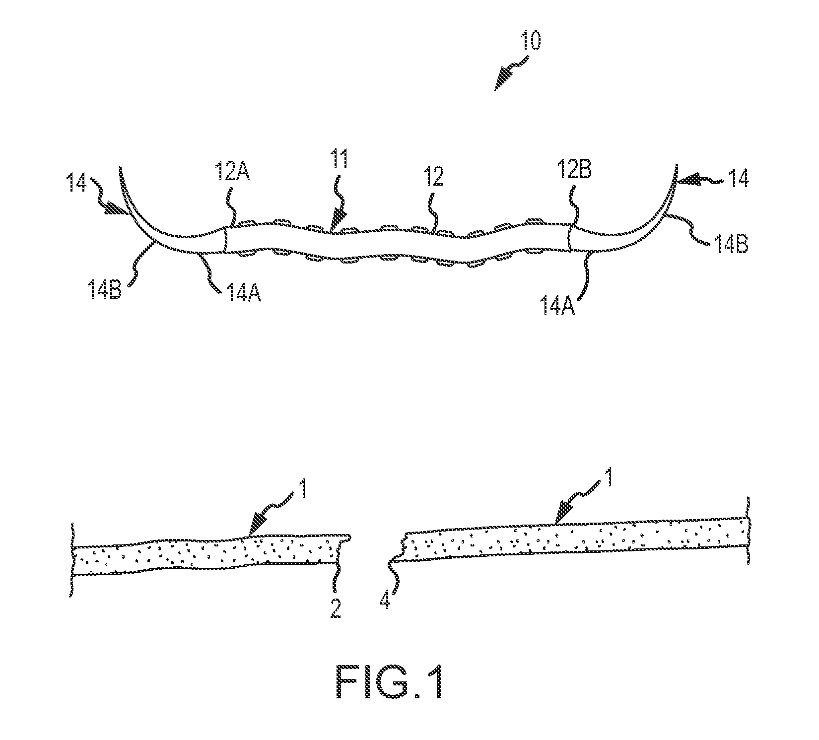 Devices and methods for tendon repair