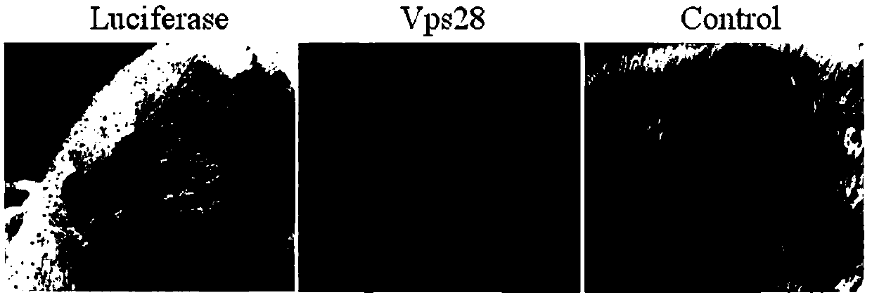 Rhipicephalus haemaphysaloides vacuolar protein sorting molecule and application thereof