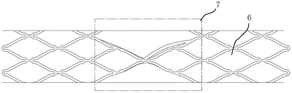 Vascular stent