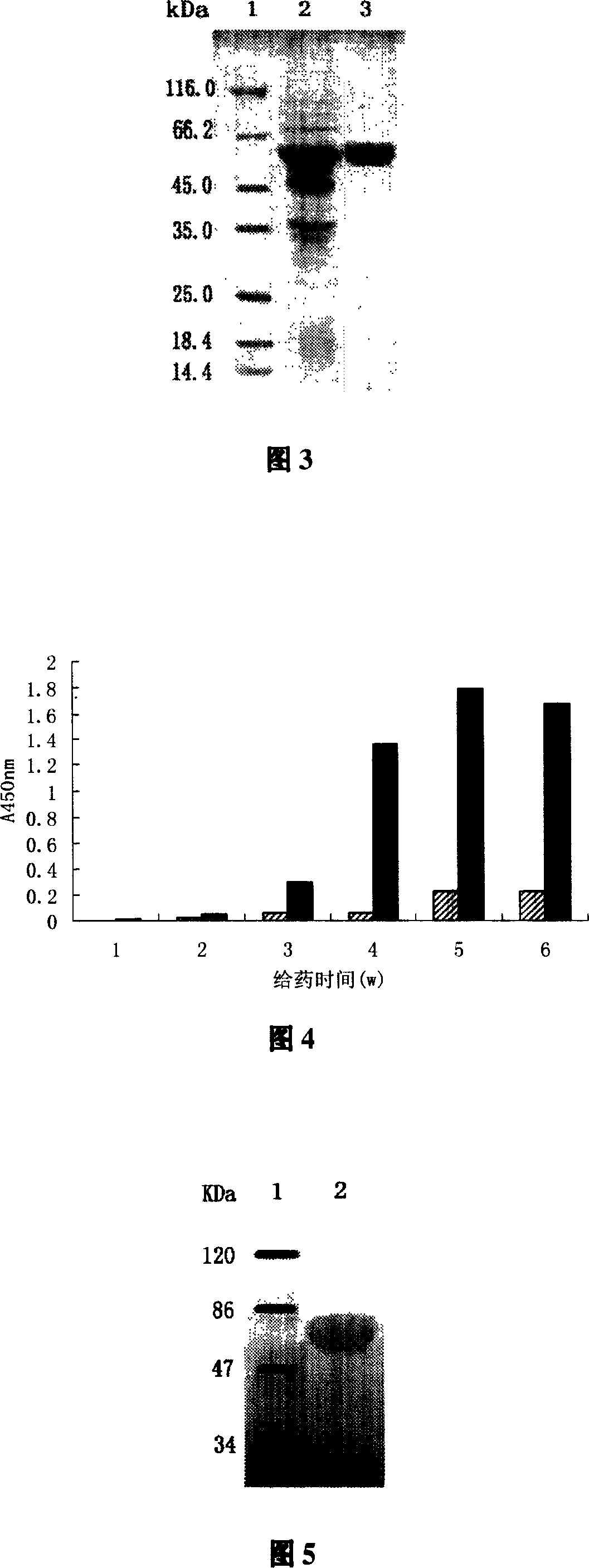 Immuno-modulatory agents with function of preventing and curing type 2 diabetes