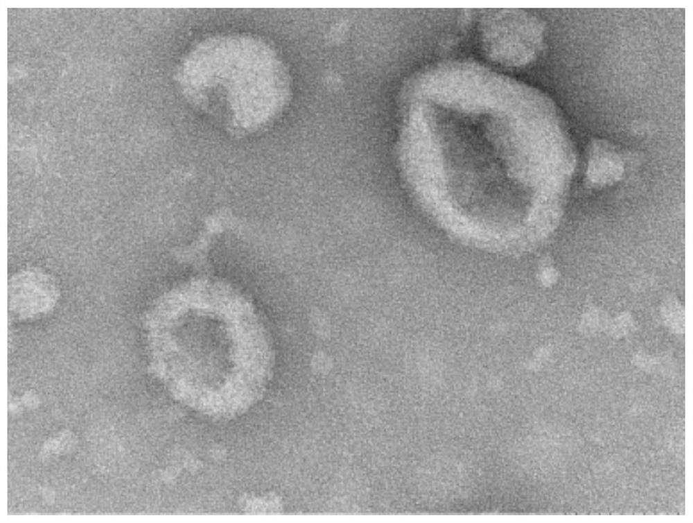 Blood exosome marker for judging buffalo birth time and application of blood exosome marker