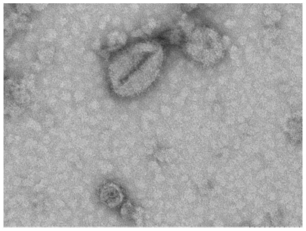 Blood exosome marker for judging buffalo birth time and application of blood exosome marker