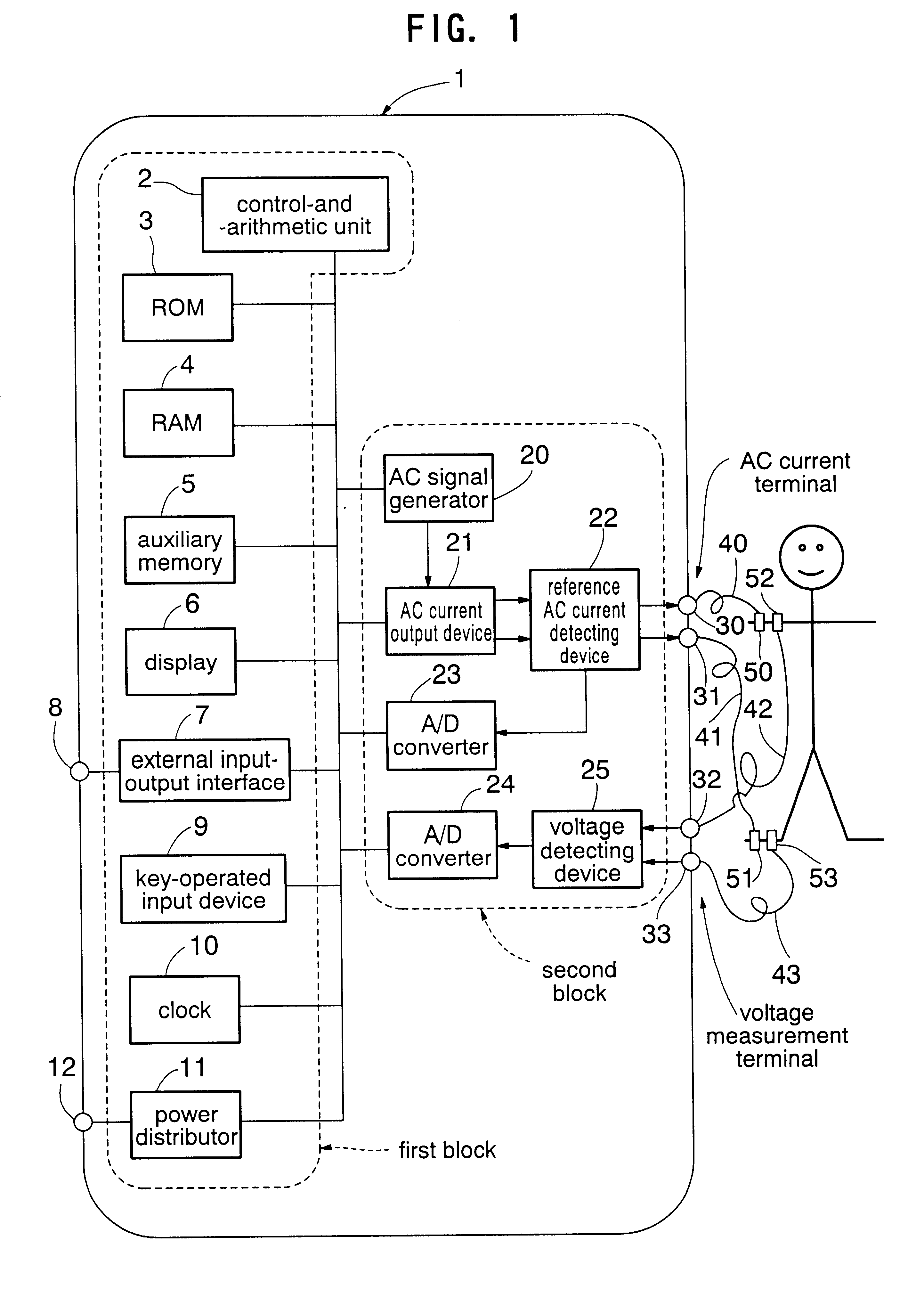 Body water amount condition judging apparatus by multi-frequency bioelectric impedance measurement