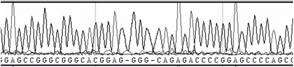 Method and primer for detecting ELA2 gene