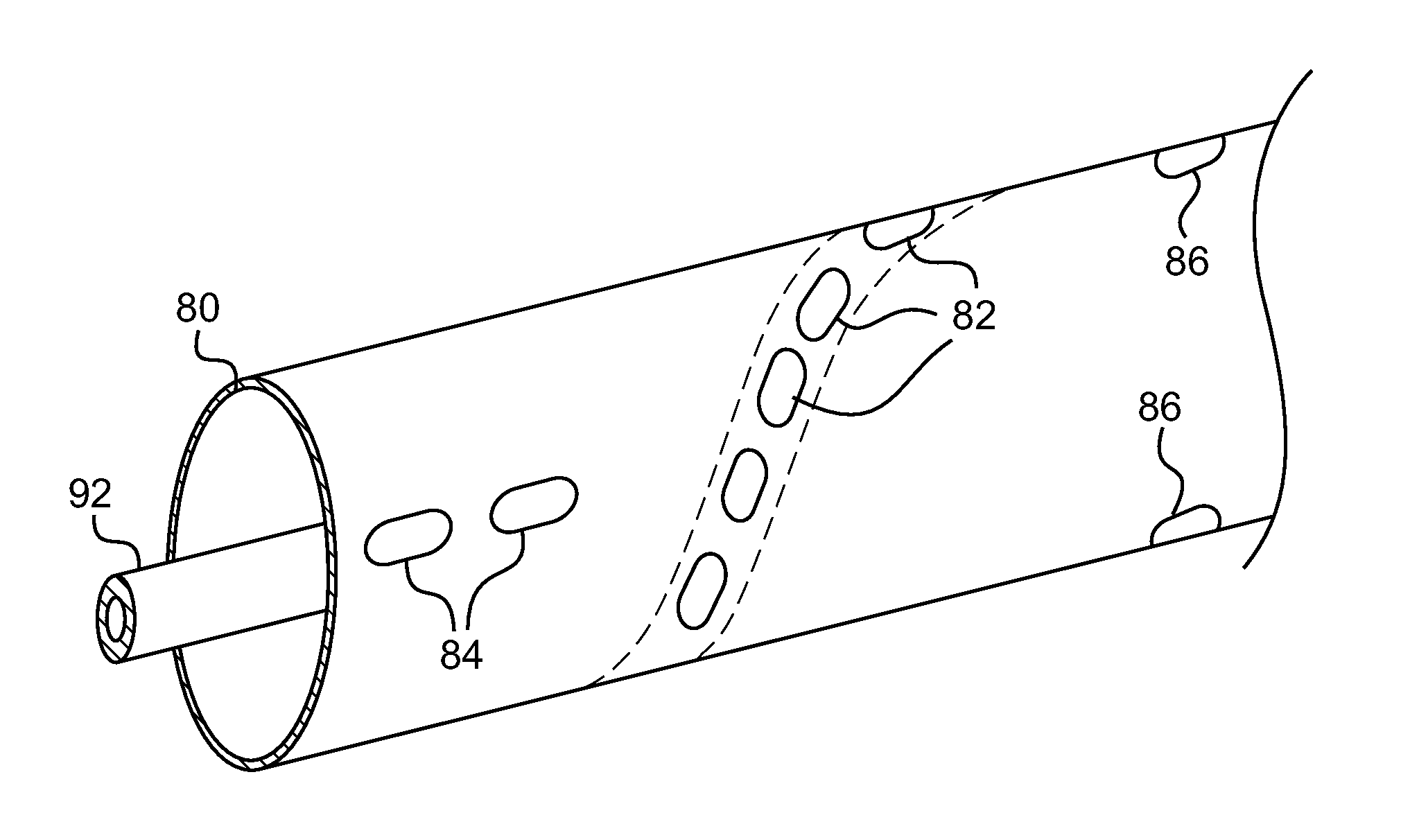 Apparatus and method of assessing transvascular denervation