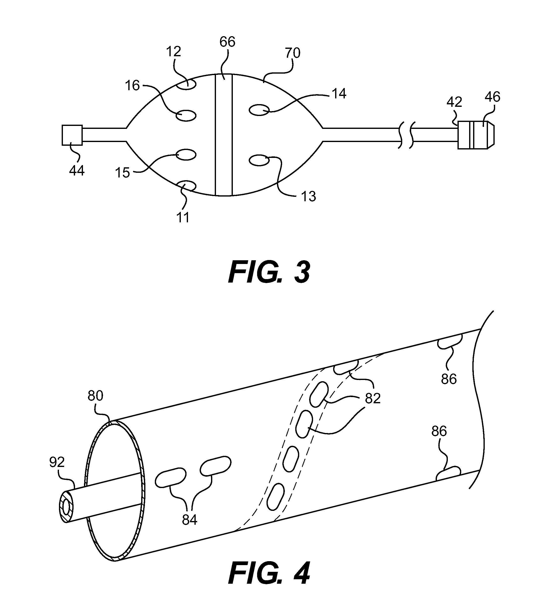 Apparatus and method of assessing transvascular denervation