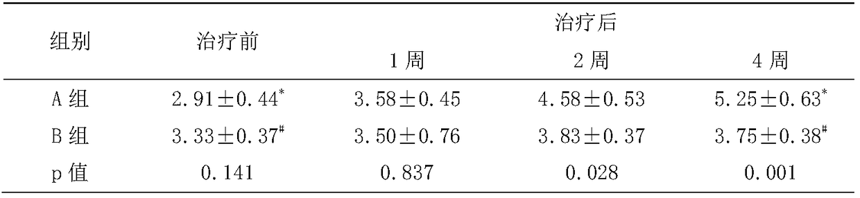 Eye drops containing exosomes for dry eye treatment and preparation method thereof