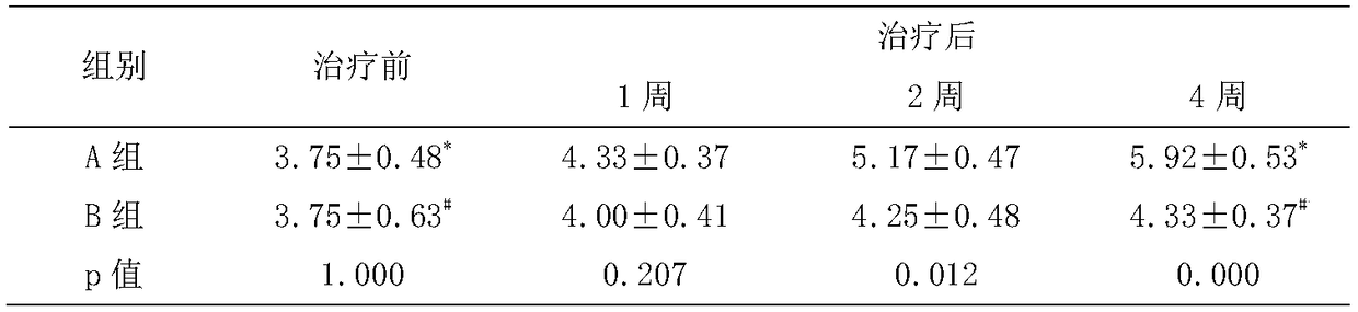 Eye drops containing exosomes for dry eye treatment and preparation method thereof