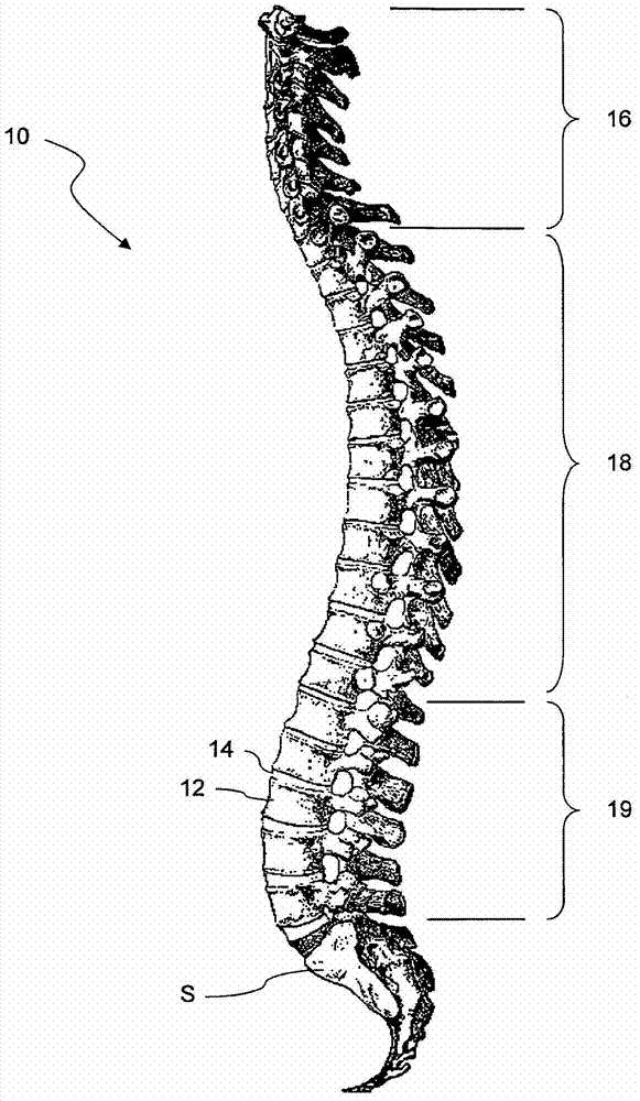 Computer program for spine mobility simulation and spine simulation method