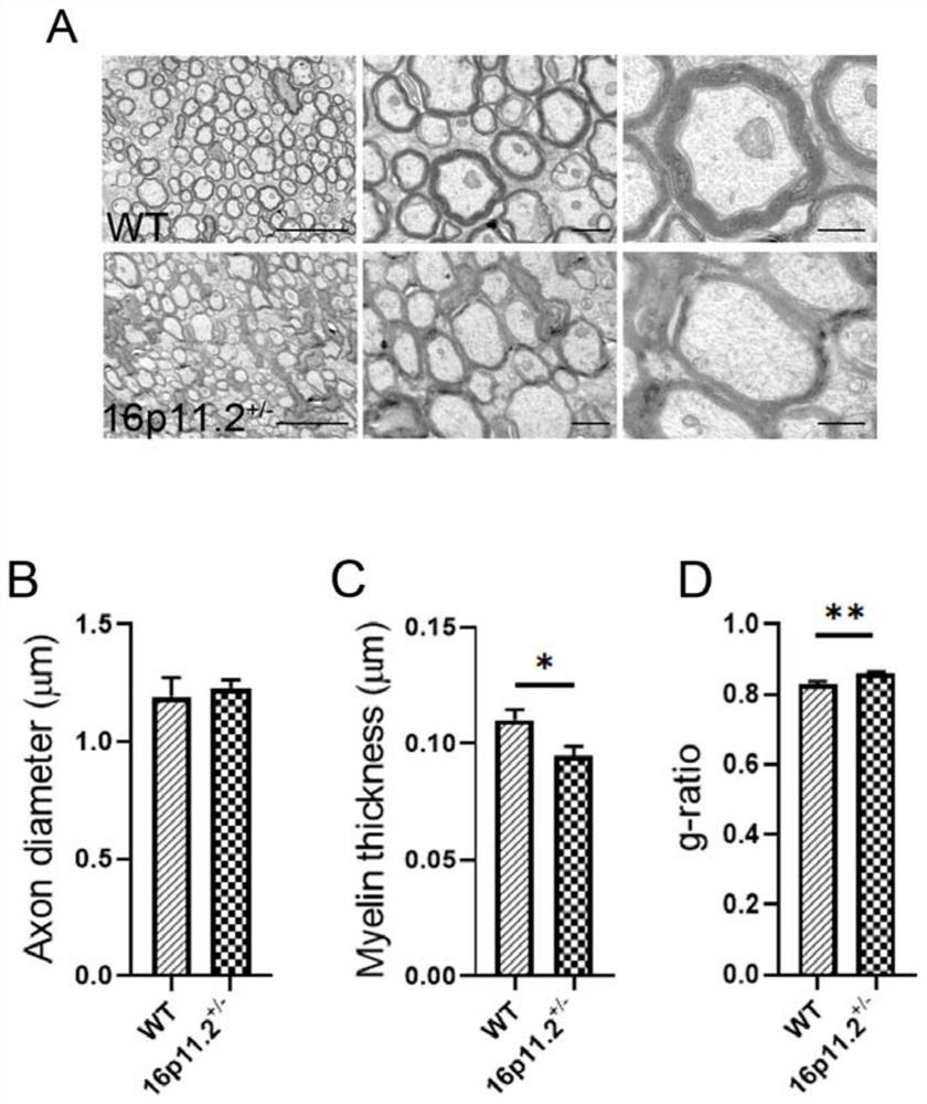 Lipid biomarker for autism and application of lipid biomarker