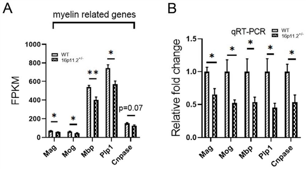 Lipid biomarker for autism and application of lipid biomarker