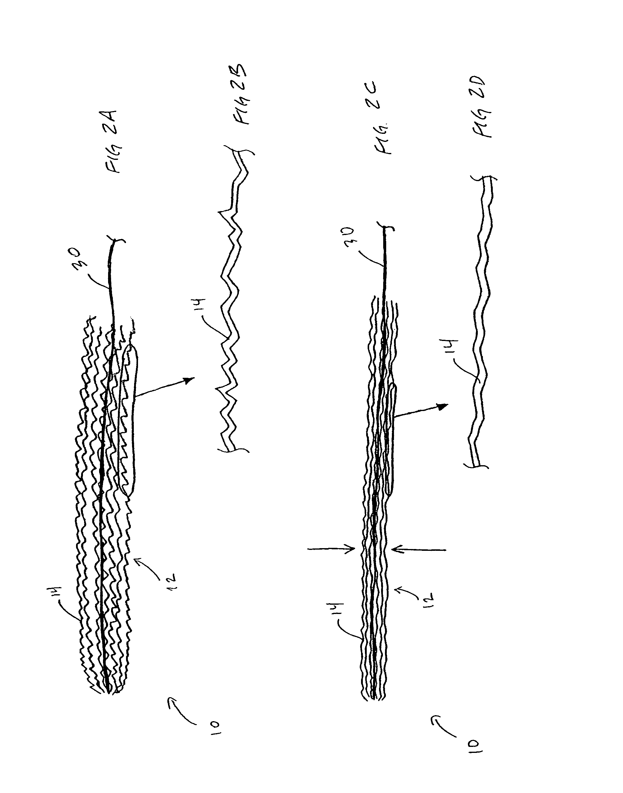 Occlusive implant and methods for hollow anatomical structure