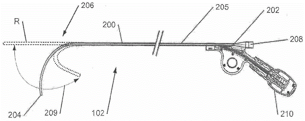 Telescoping Catheter Delivery System for Intracardiac Device Placement in the Left Heart