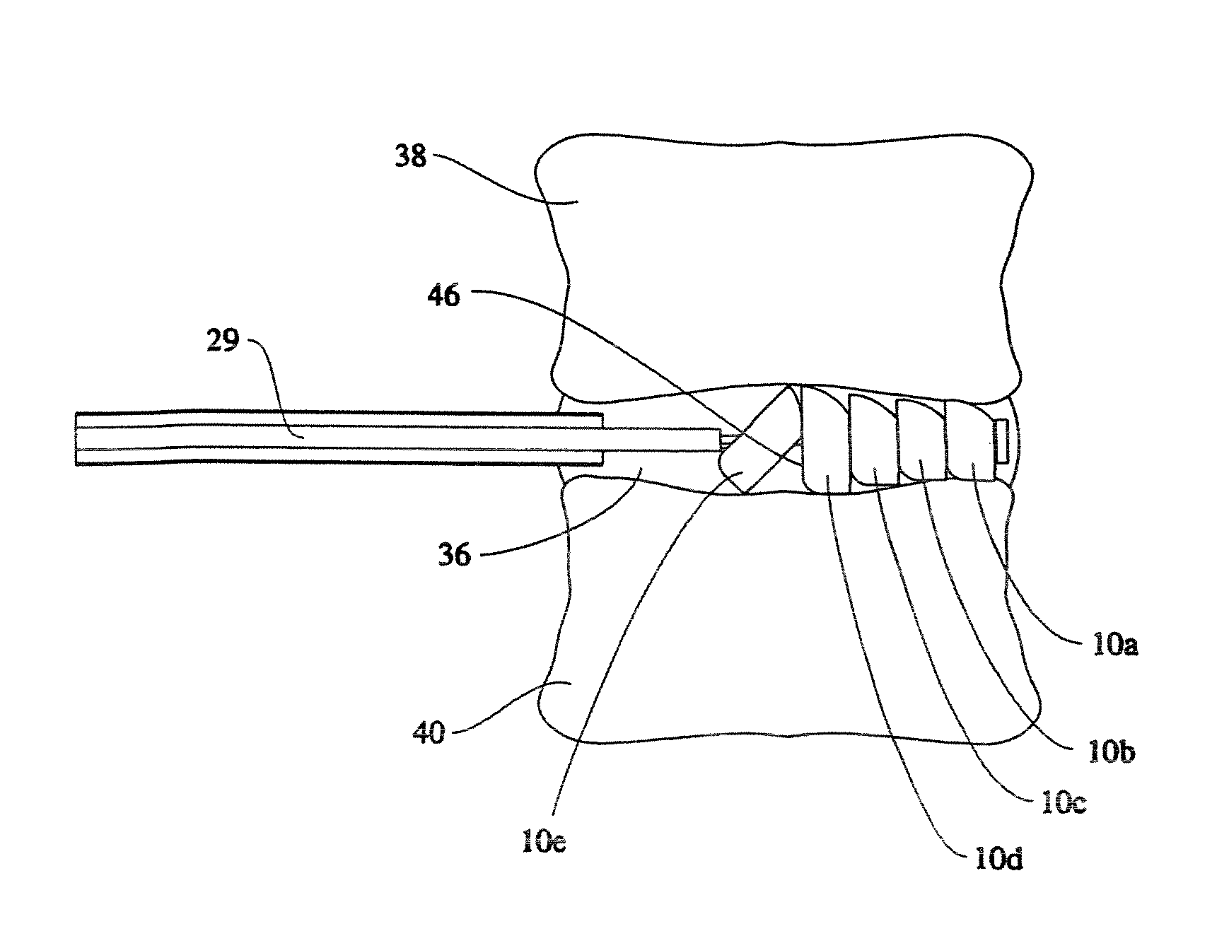 Linked slideable and interlockable rotatable components