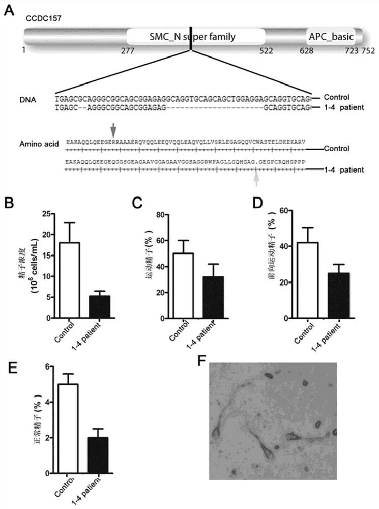 Application of ccdc157 gene and its mutant gene as molecular markers in the diagnosis of male infertility