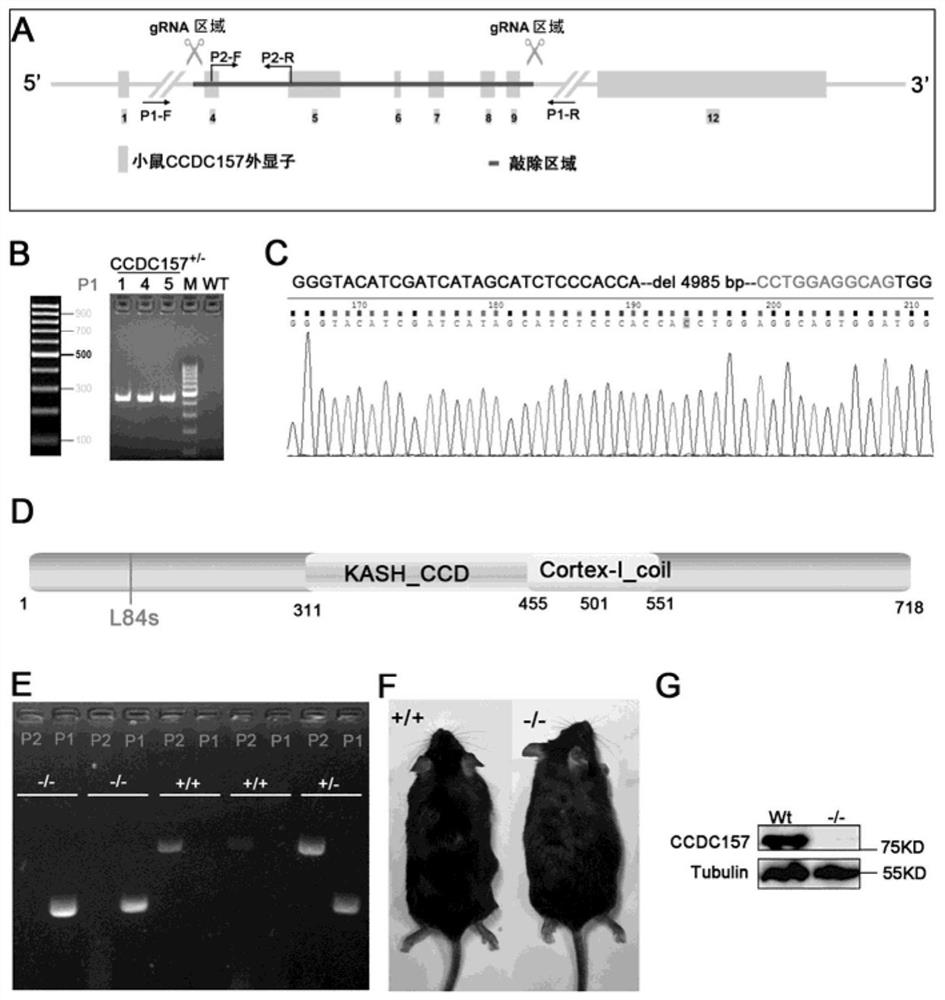 Application of ccdc157 gene and its mutant gene as molecular markers in the diagnosis of male infertility