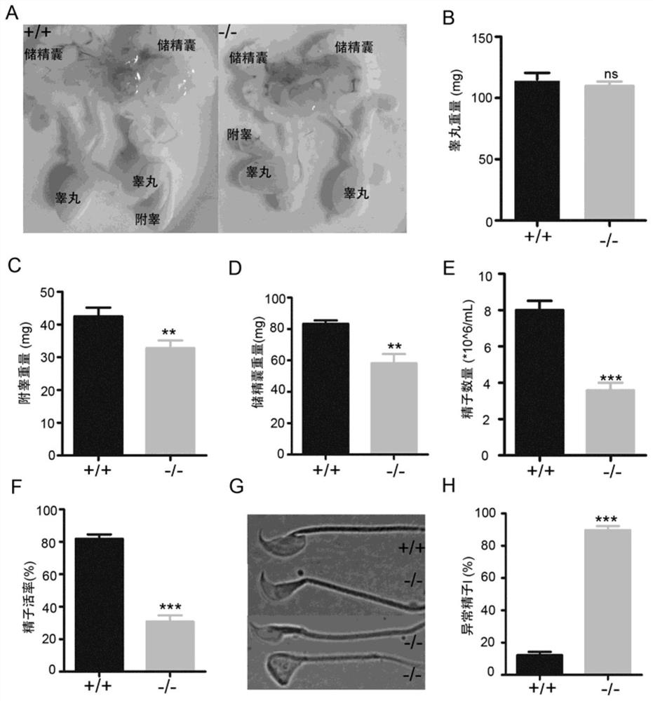 Application of ccdc157 gene and its mutant gene as molecular markers in the diagnosis of male infertility