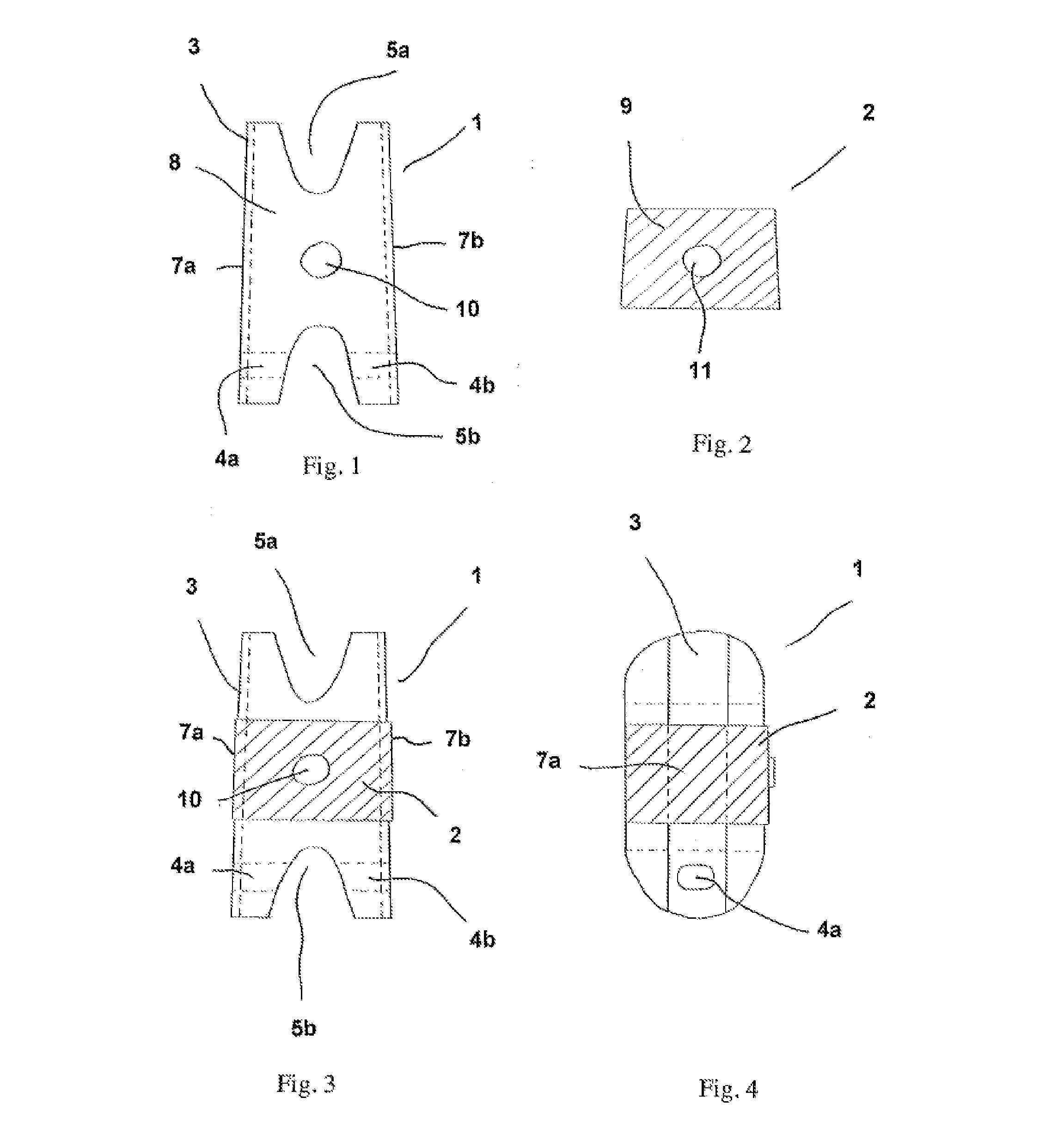 Intervertebral dynamic fixation implant