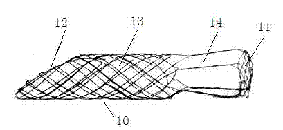 Intravascular stent with complex functions