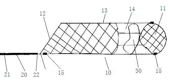 Intravascular stent with complex functions