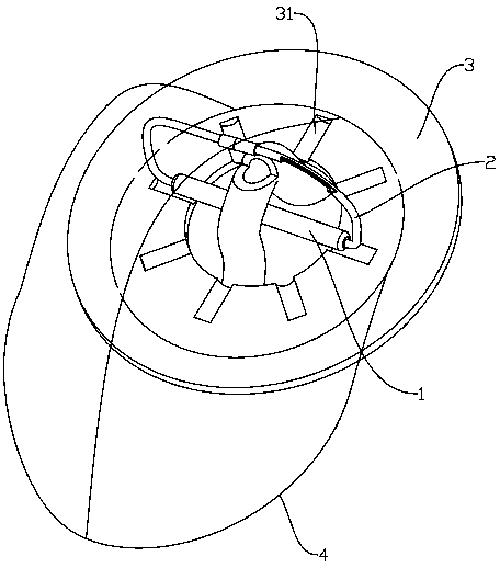 Intestinal loop type stoma stent and stoma bag using intestinal loop type stoma stent