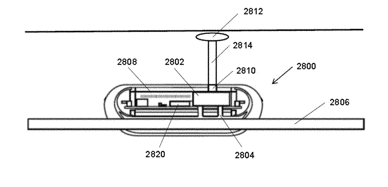 Systems and methods for establishing a nerve block