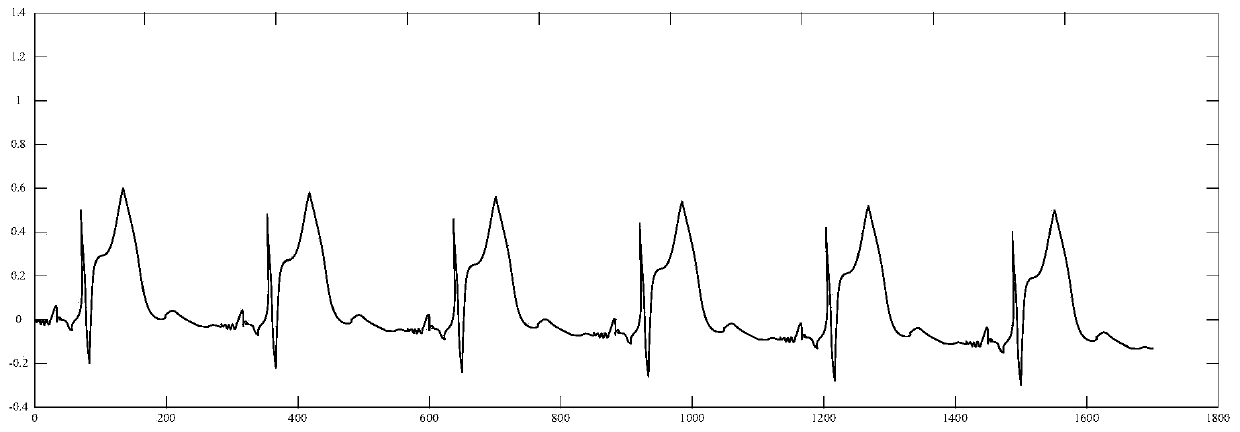 Electrocardiosignal processing method and device, storage medium and processor